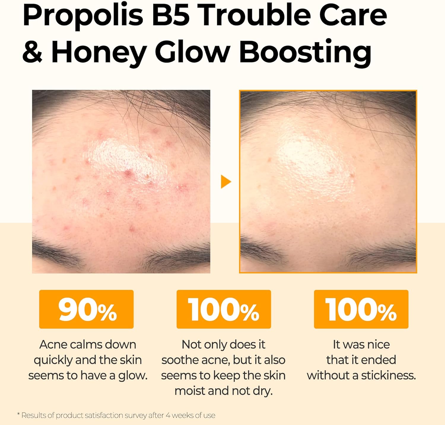 Some By Mi, Propolis B5, Glow Barrier Calming Toner, 5.07 fl oz (150 ml), Acne Care, Brightening, Anti-Wrinkle, Anti-Inflammatory, Moisture Barrier, Sebum Care